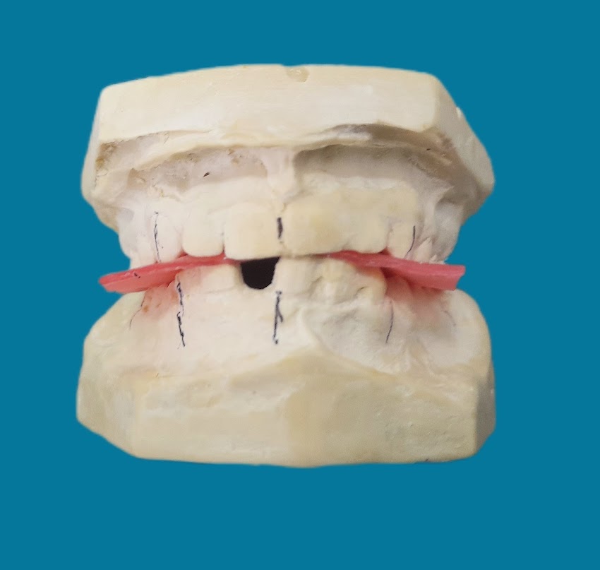 DOCTOR GONZALO MORENO CIRUGIA ORAL Y MAXILOFACIAL ESTOMATOLOGIA
