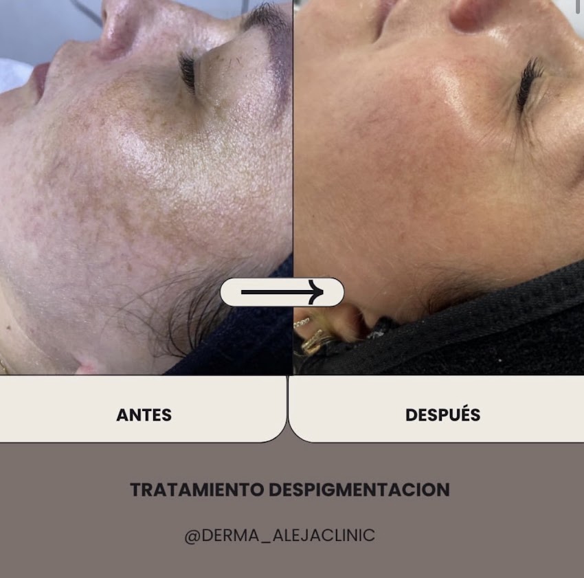 dermocosmiatra cosmetologa | derma Aleja Clinic