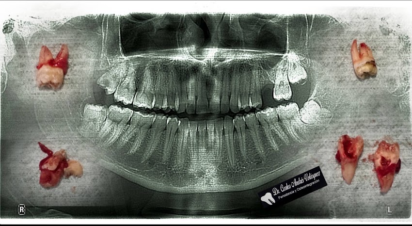 Consultorio Odontológico Dr.Carlos Velasquez